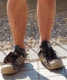 adidas | スニーカー