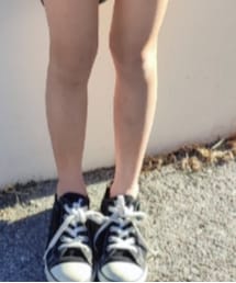 CONVERSE ALL STAR | スニーカー