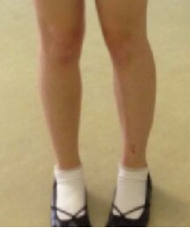 Nordstrom | バレエシューズ