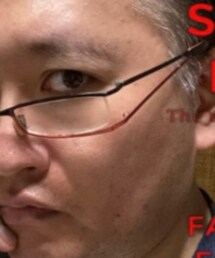 Dr'EYE's | メガネ