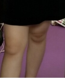 H&M | ワンピース
