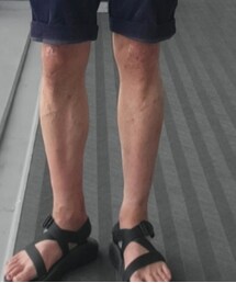 Chaco | サンダル