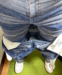 脱皮 | 一皮剥けた😗(その他)