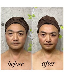 新春ビフォーアフター🤣 | 末吉だけど良いことあったね💗(その他)
