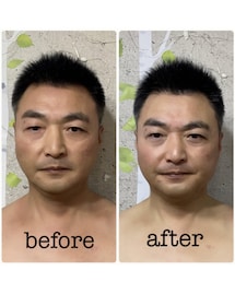 旦那さんビフォーアフター🤣 | 顔がコワくてすみません(その他ビューティーグッズ)