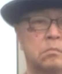 怪我 | その他