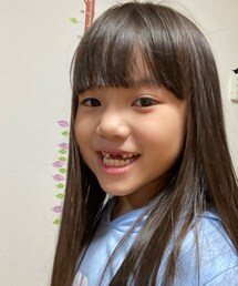 前歯2本抜けた | その他