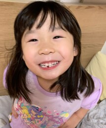歯抜けました🦷 | その他