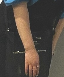 Acne Studios | バッグ