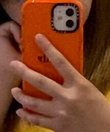 CASETiFY | スマホケース/カバー