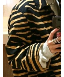 H&M | その他アウター