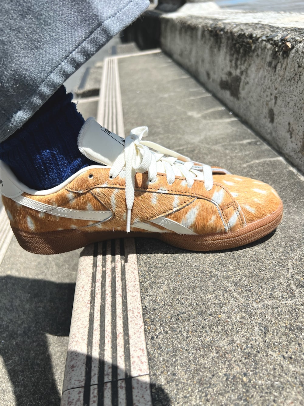 コーディネート