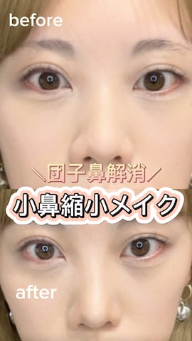 「アイテム（ベースメイク）」を使った、MIRAIさん（レディース・162cm・20代）の春コーディネート